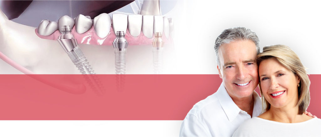 Campanie-Fast-and-Fix-web-03-1024x438