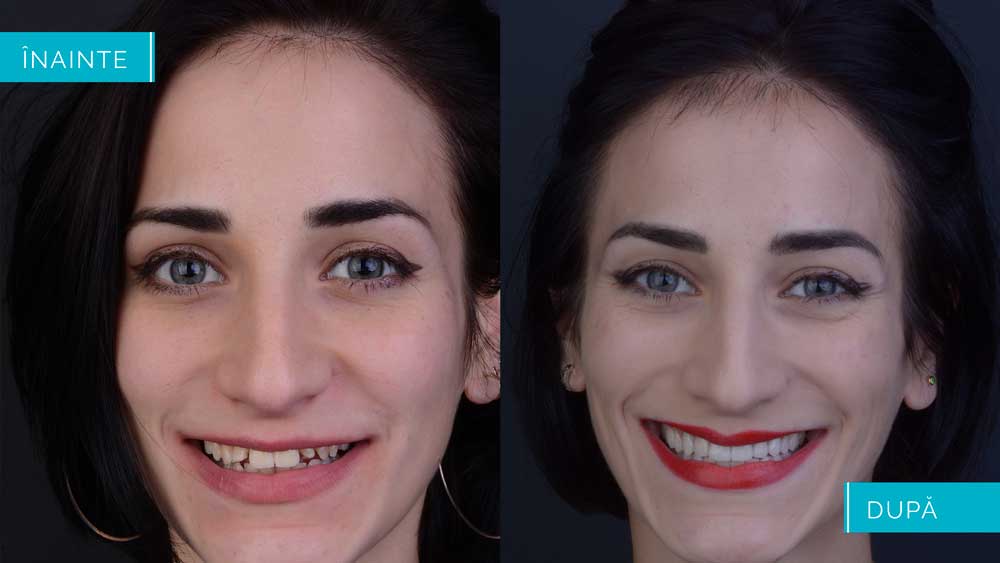 Simonescu-prezentare.003