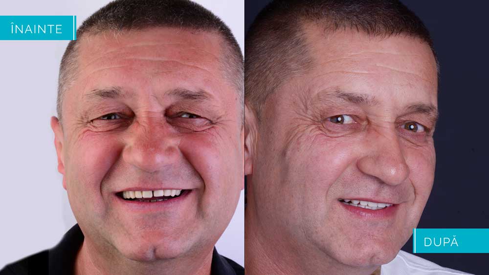 Simonescu-prezentare.003