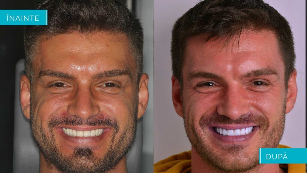 inainte-dupa-1600x900