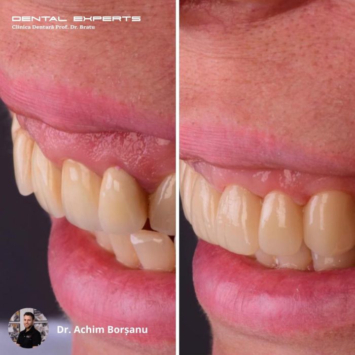 298592573_596691935179098_7877709645489265955_n-700x700