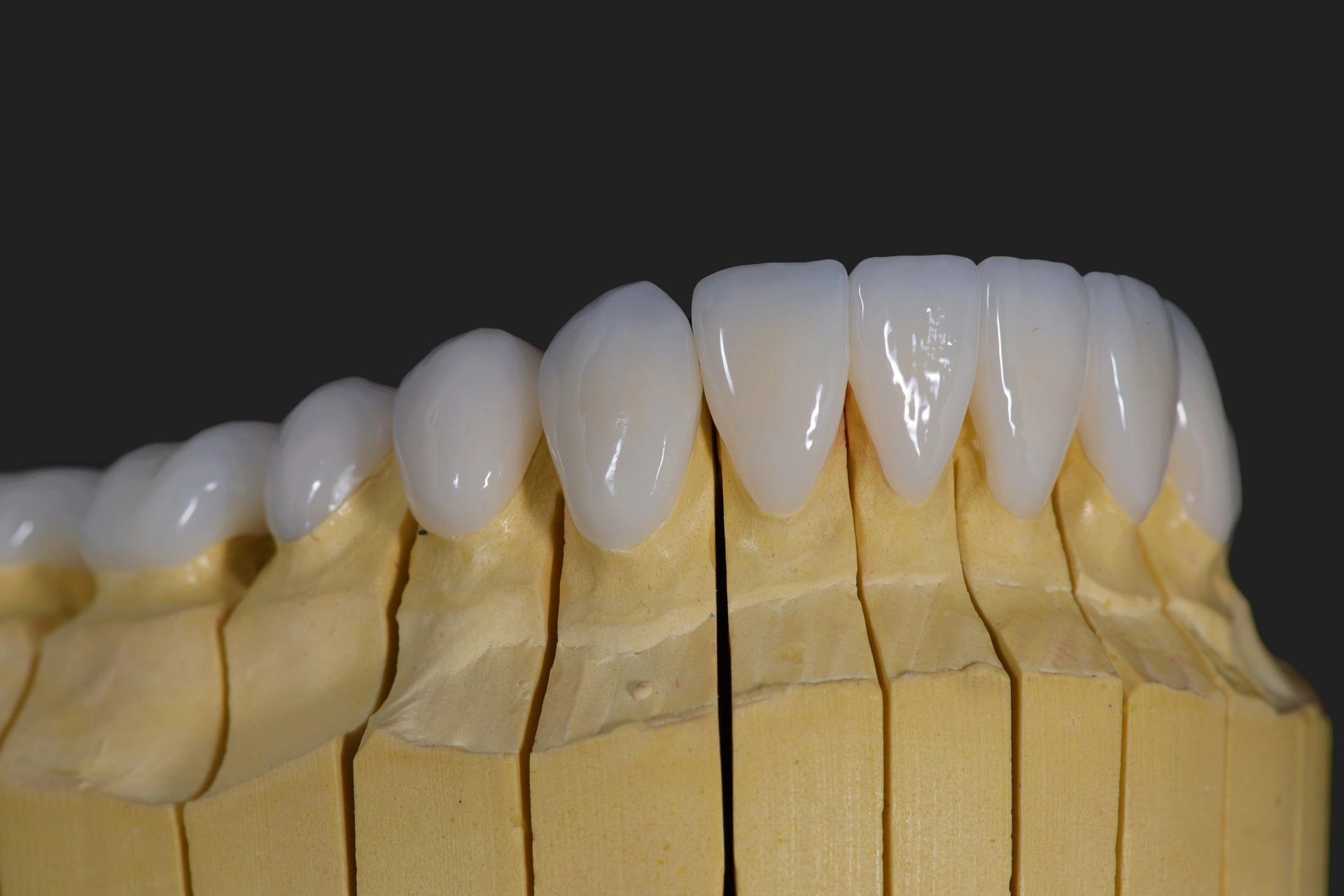 fatete dentare dental experts