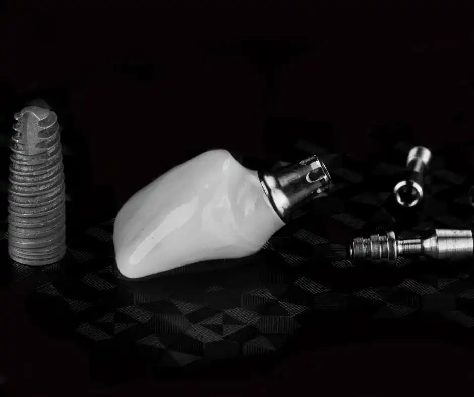 impland-dental-experts copy